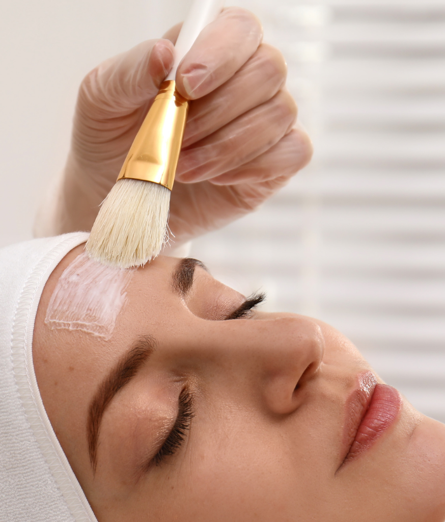 Chemical Rejuvenation Peels