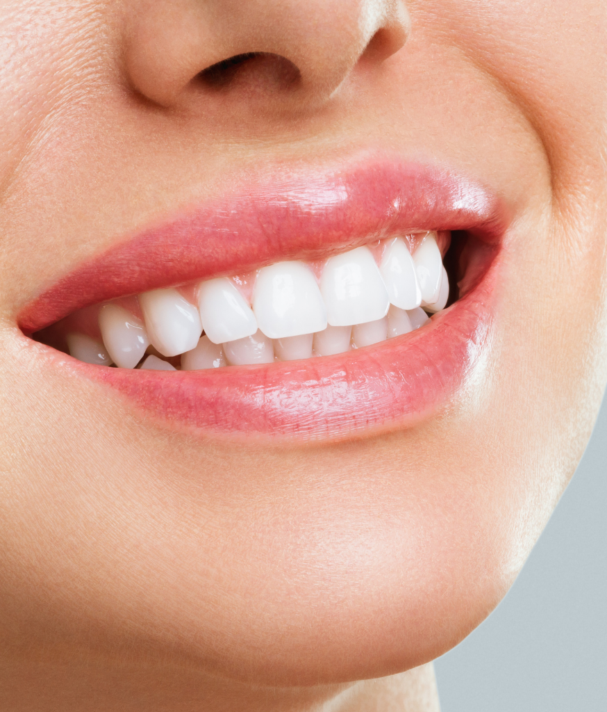 Teeth Whitening